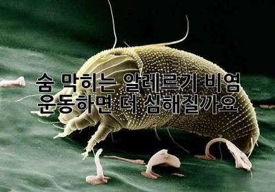 숨 막히는 알레르기 비염, 운동하면 더 심해질까요?